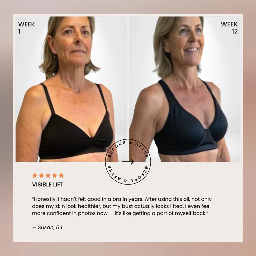 🔥Naturally Lifted, Fuller Bust - Without Surgery, Pills or Padding 🔥