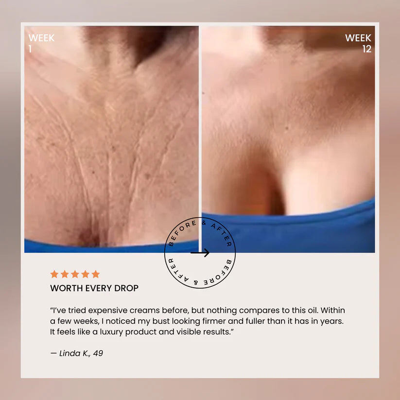 🔥Naturally Lifted, Fuller Bust - Without Surgery, Pills or Padding 🔥