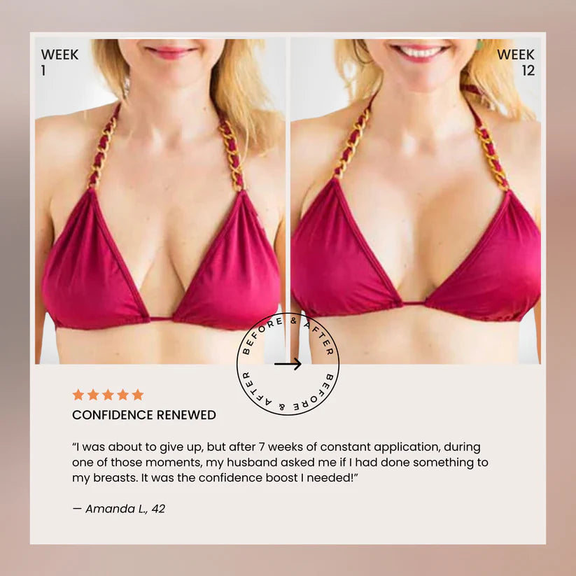 🔥Naturally Lifted, Fuller Bust - Without Surgery, Pills or Padding 🔥